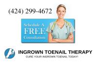 Ingrown Toenail Therapy Houston image 5